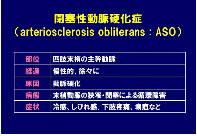 閉塞性動脈硬化症